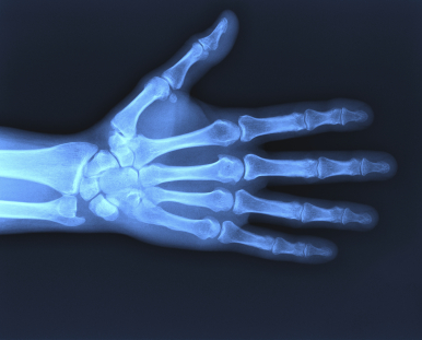 xray